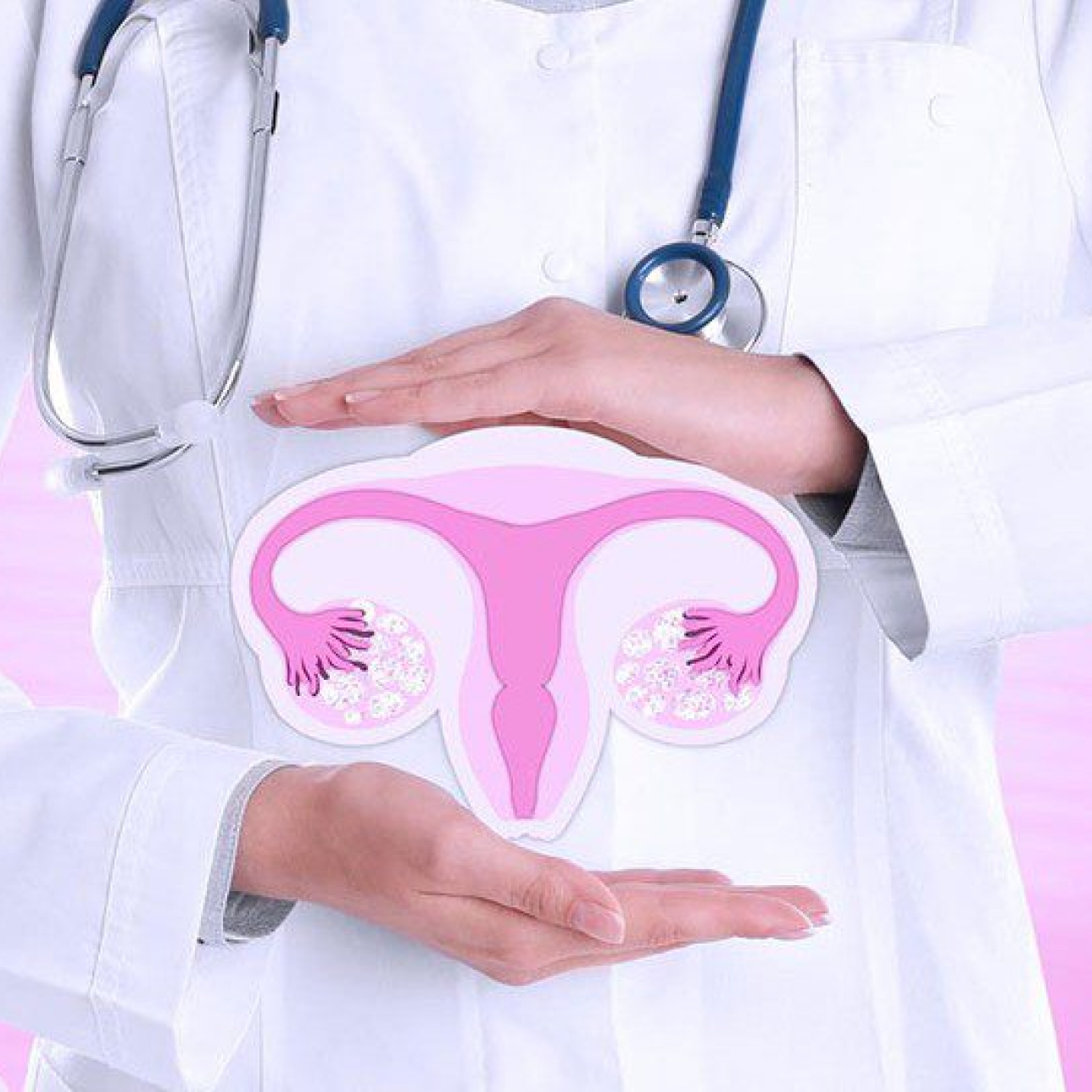 Kidney Transplant